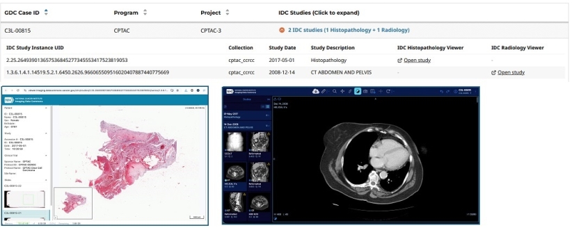 Imaging Data Commons (IDC) Image Viewer Tool